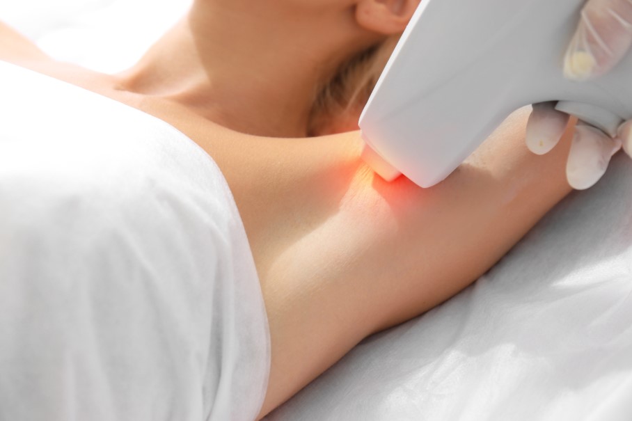 Trwała epilacja laserowa specjalistycznym sprzętem pach u kobiet